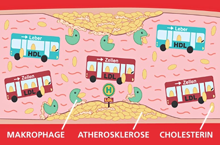 gutes_hdl_und_schlechtes_ldl_cholesterin_busse_1